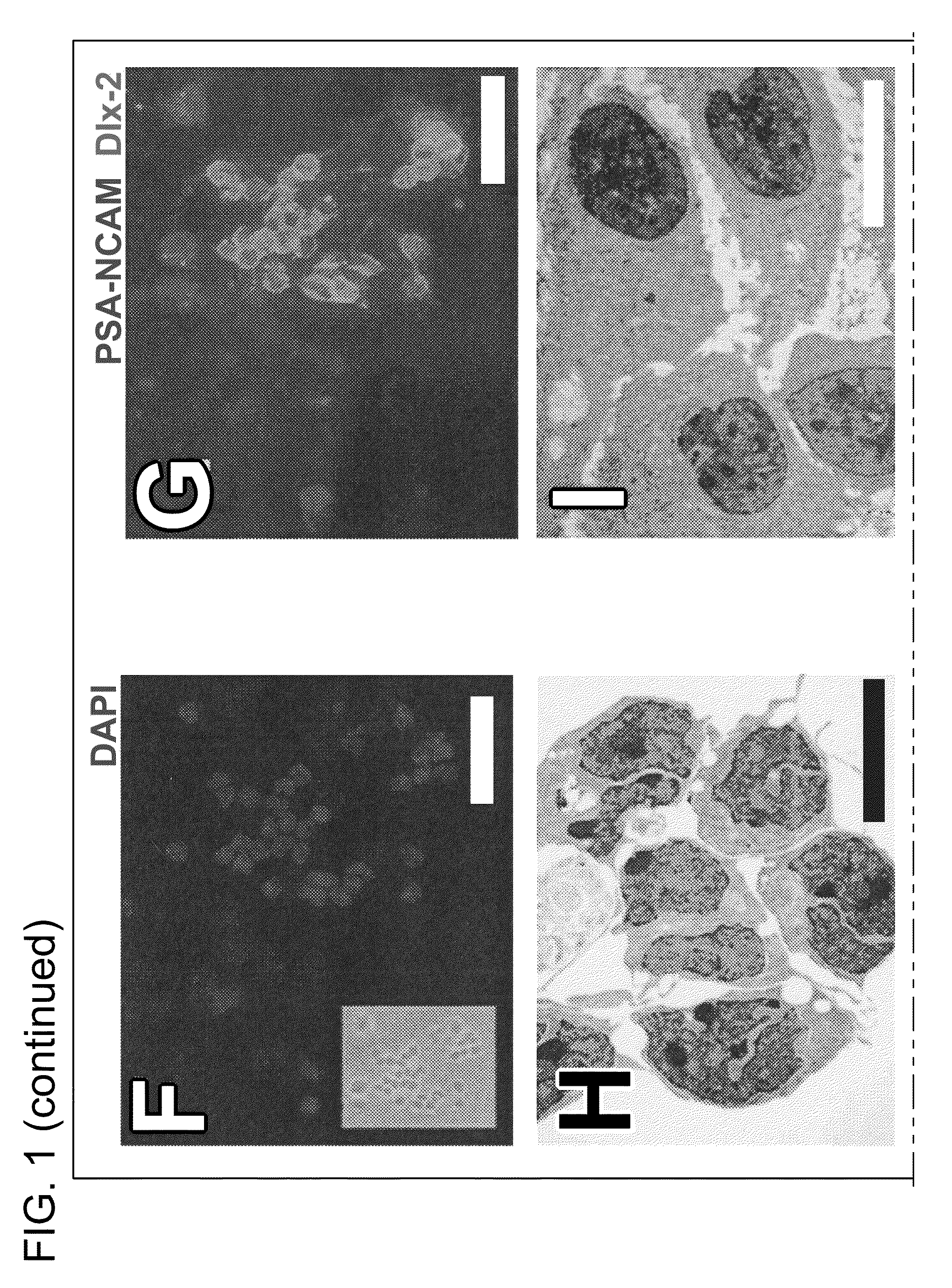 Culturing and differentiating neural precursor cells