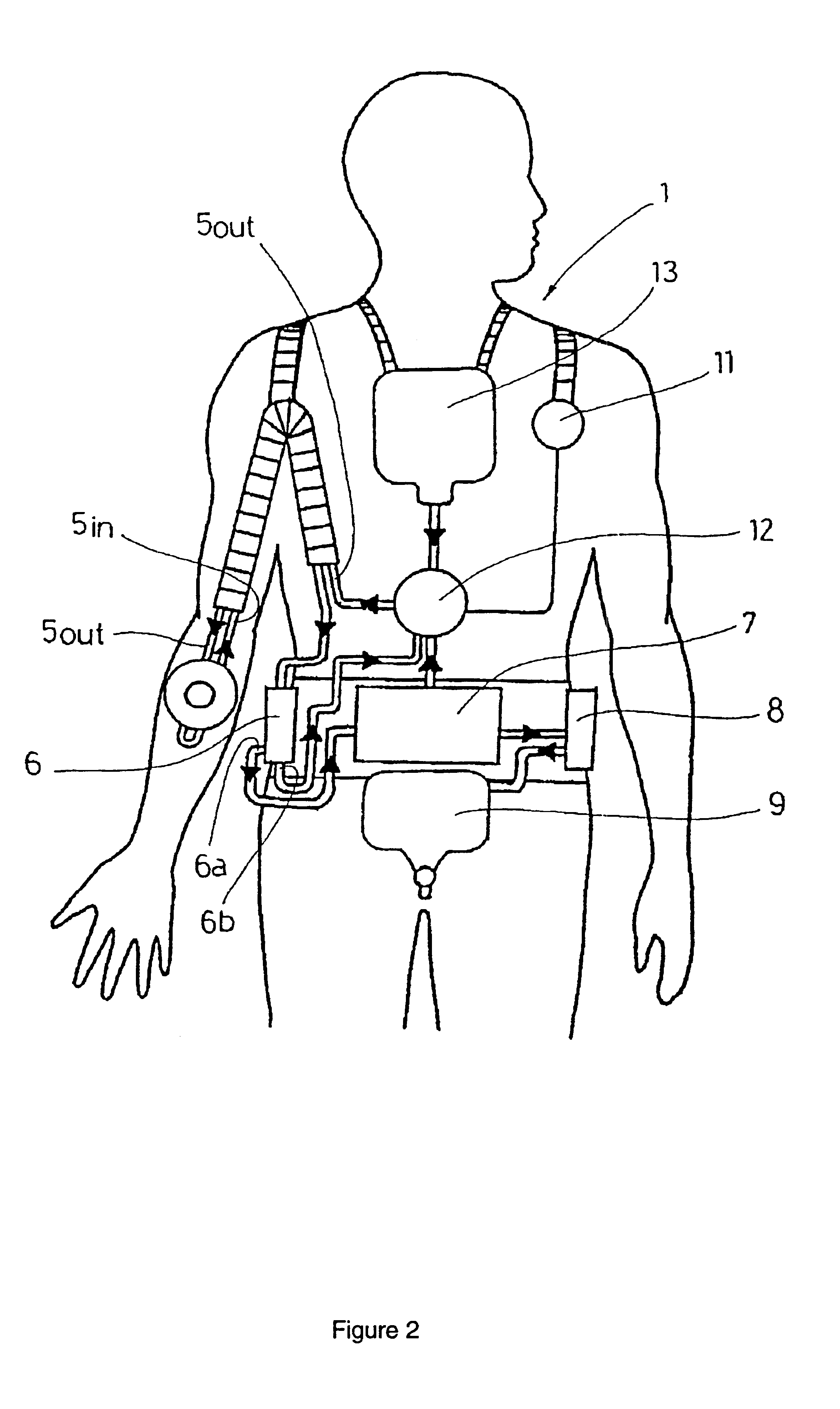 Artificial kidney and an insertion guide used therein