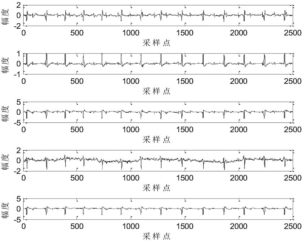 Fetus electrocardiogram signal extracting method