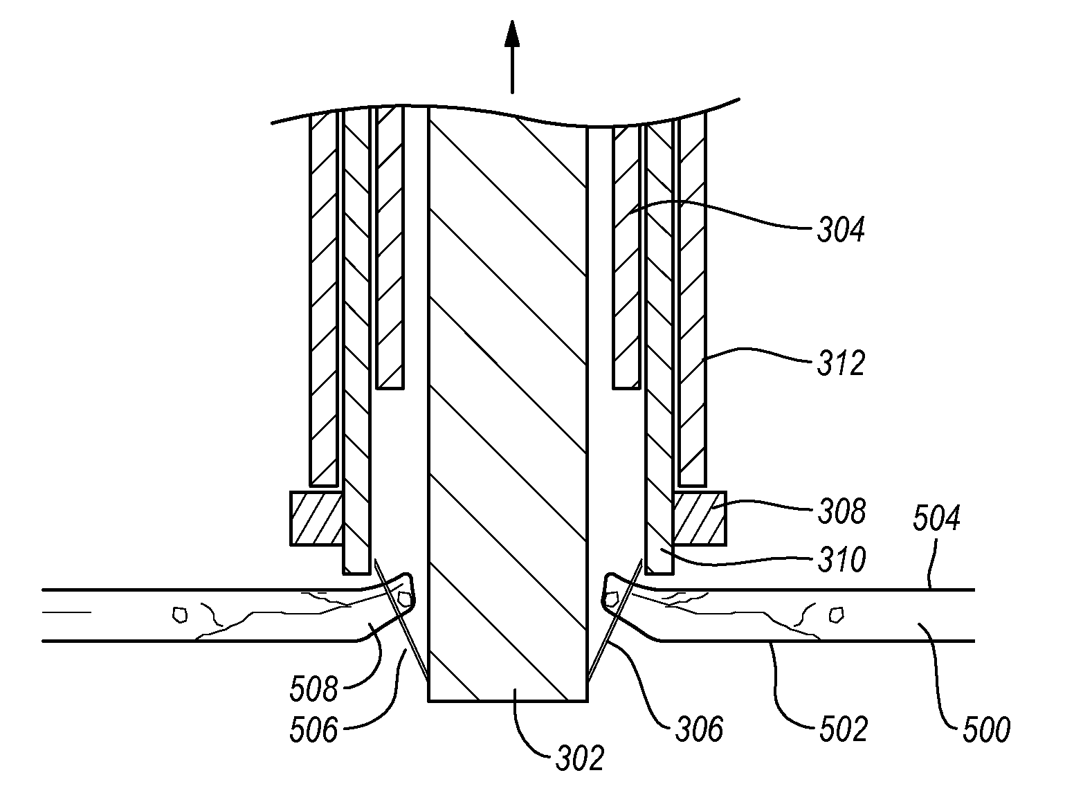 Tissue eversion apparatus and tissue closure device and methods for use thereof