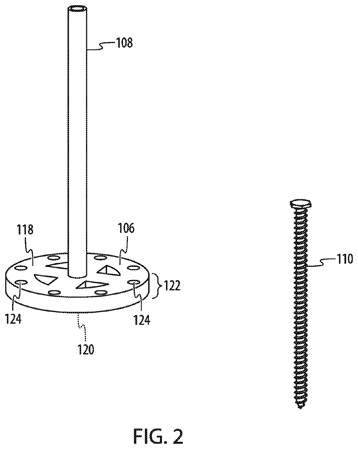 Transplantation Methods and Devices for Bone Surface Contouring