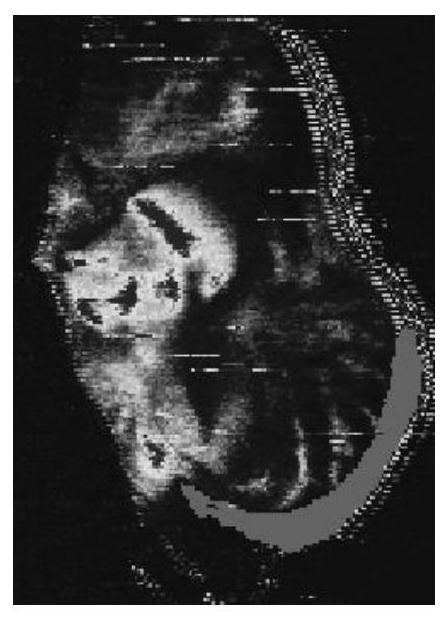 A traditional Chinese medicine composition for dermatitis and preparation method thereof