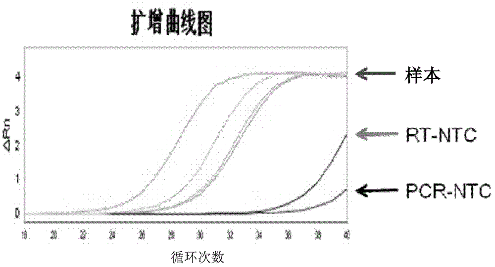 Serum miR-21 (micro-ribonucleic acid-21) detection kit based on luorescence quantitative PCR (polymerase chain reaction) and application thereof