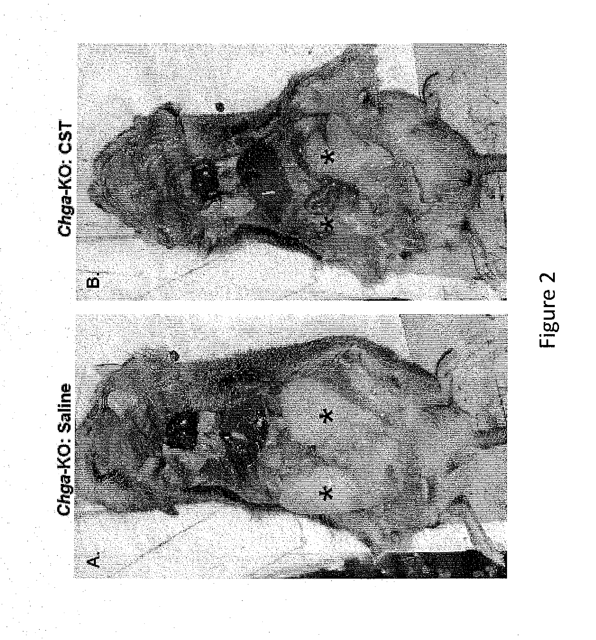 Methods for promoting lipolysis and oxidation in liver and adipose tissue using catestatin