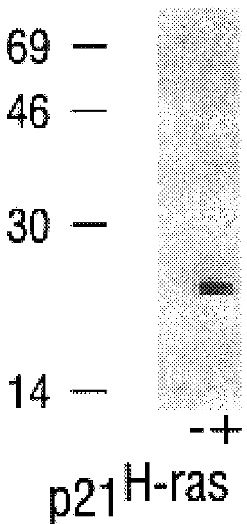 Methods and compositions for the identification, characterization and inhibition of farnesyltransferase