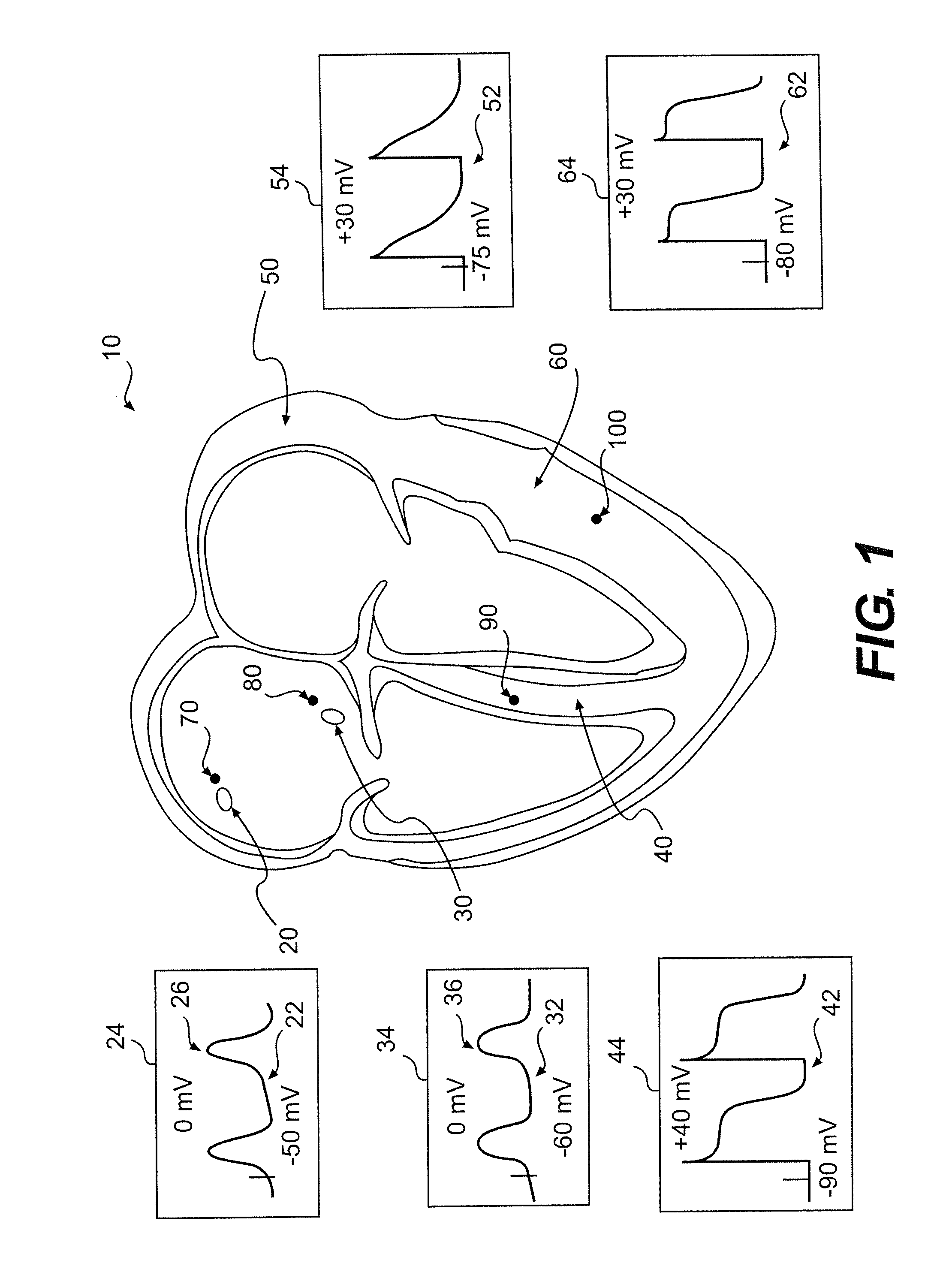 System And Method For Local Field Stimulation