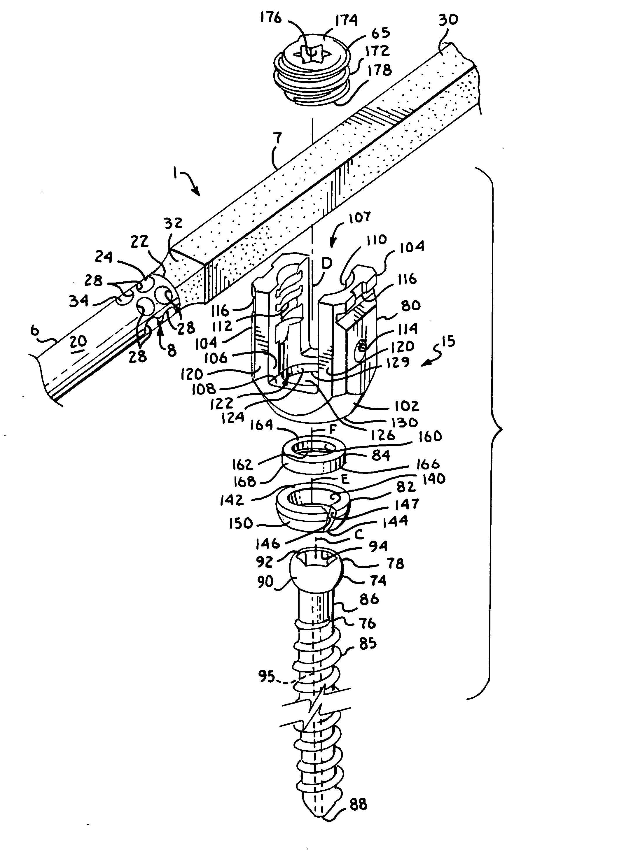 Dynamic stabilization member with molded connection