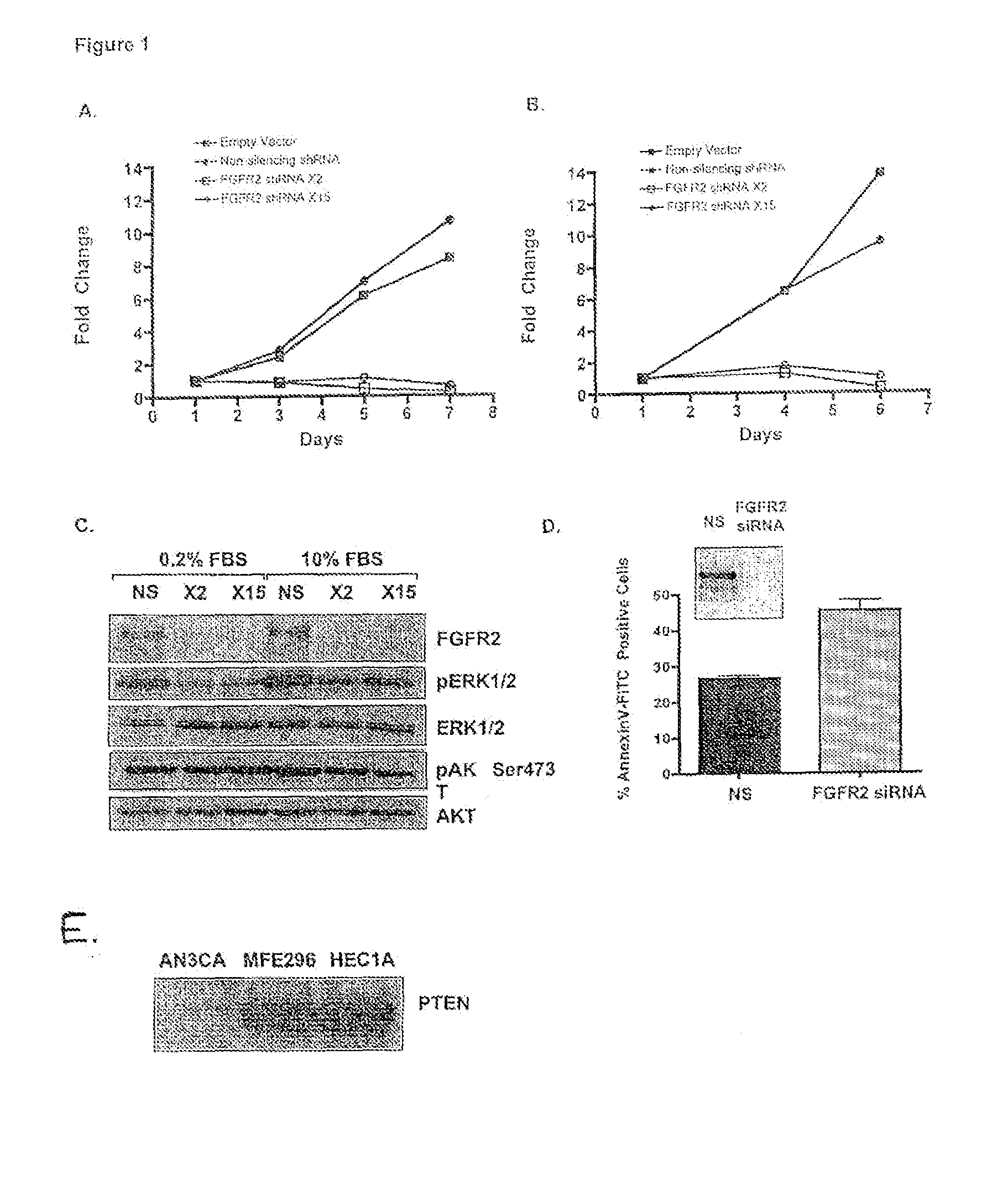 Method of diagnosing, classifying and treating endometrial cancer and precancer