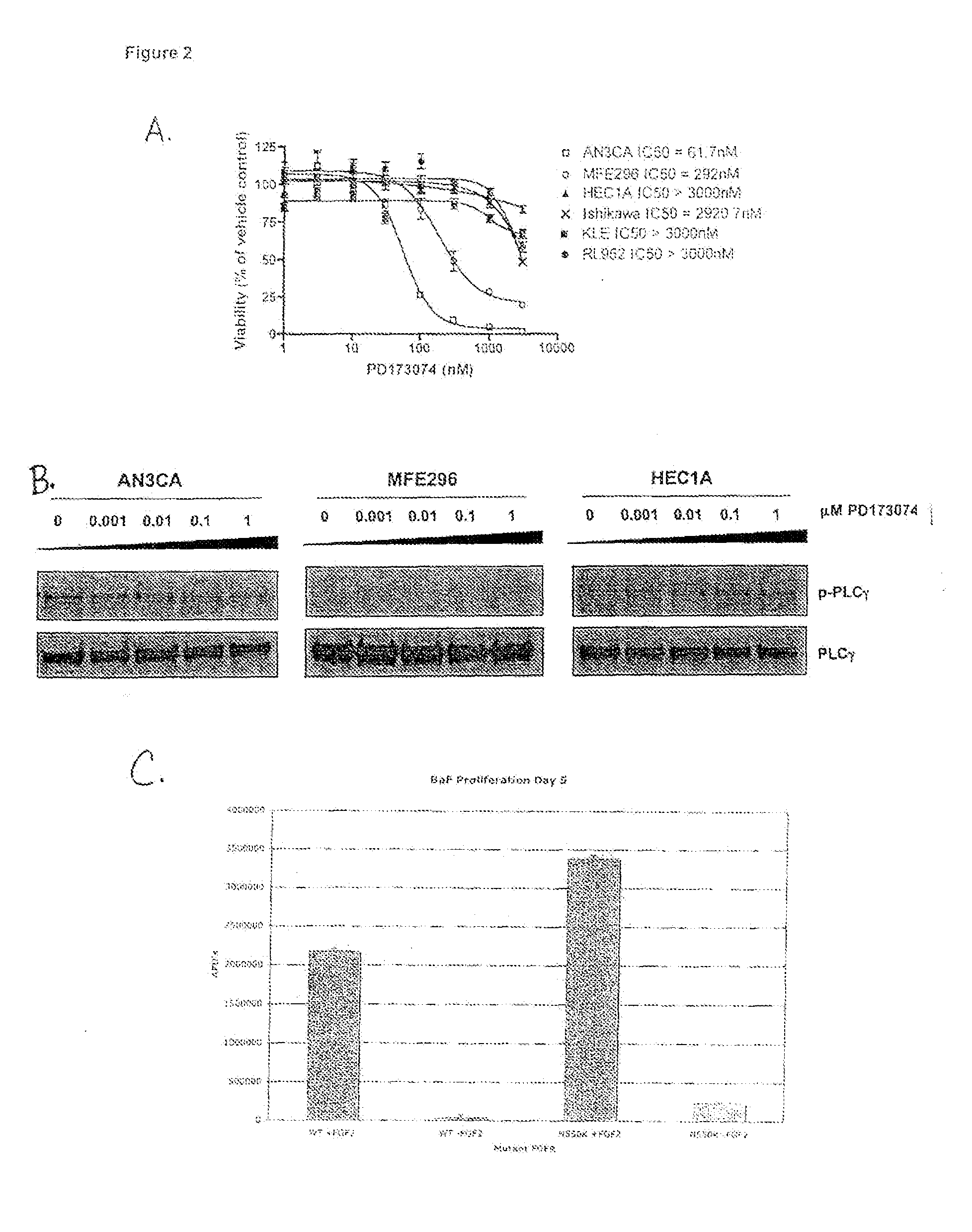 Method of diagnosing, classifying and treating endometrial cancer and precancer
