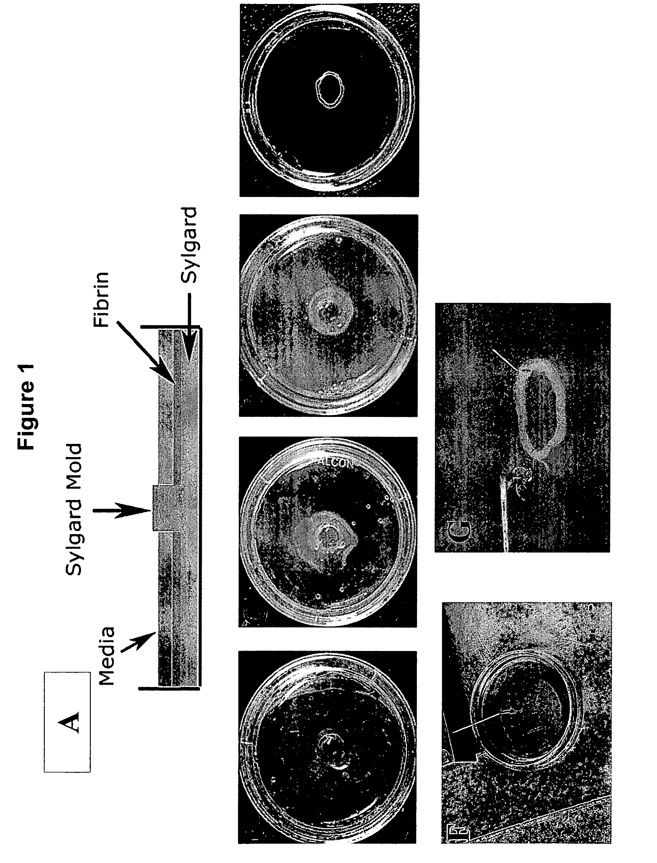 Three dimensional bioengineered smooth muscle tissue and sphincters and methods therefor
