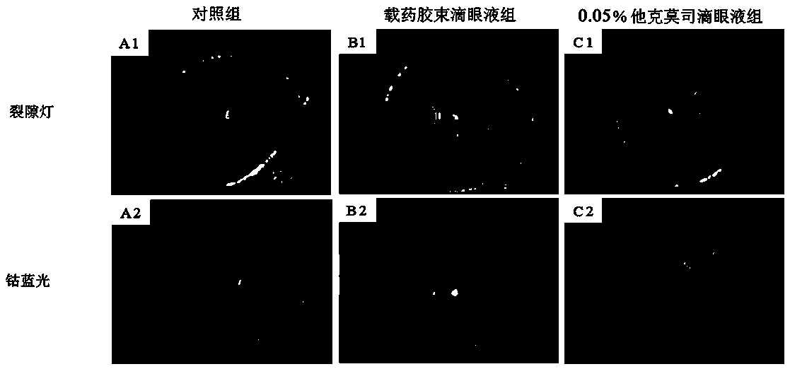 Tacrolimus loaded micelle and preparation method and applications thereof