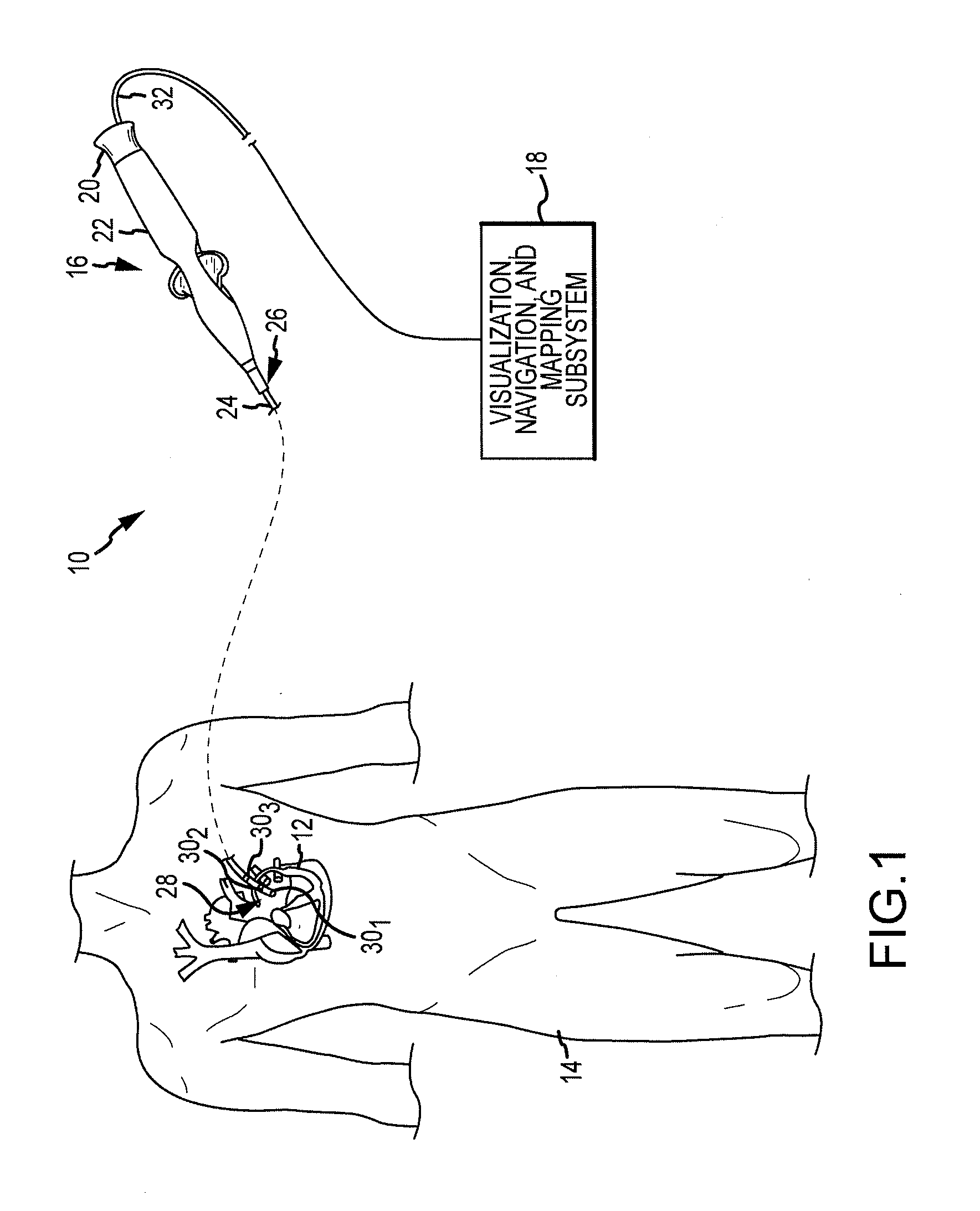 System and Method for Diagnosing Arrhythmias and Directing Catheter Therapies