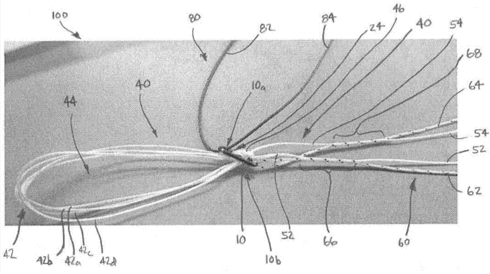 Implant having filament limbs of an adjustable loop disposed in a shuttle suture