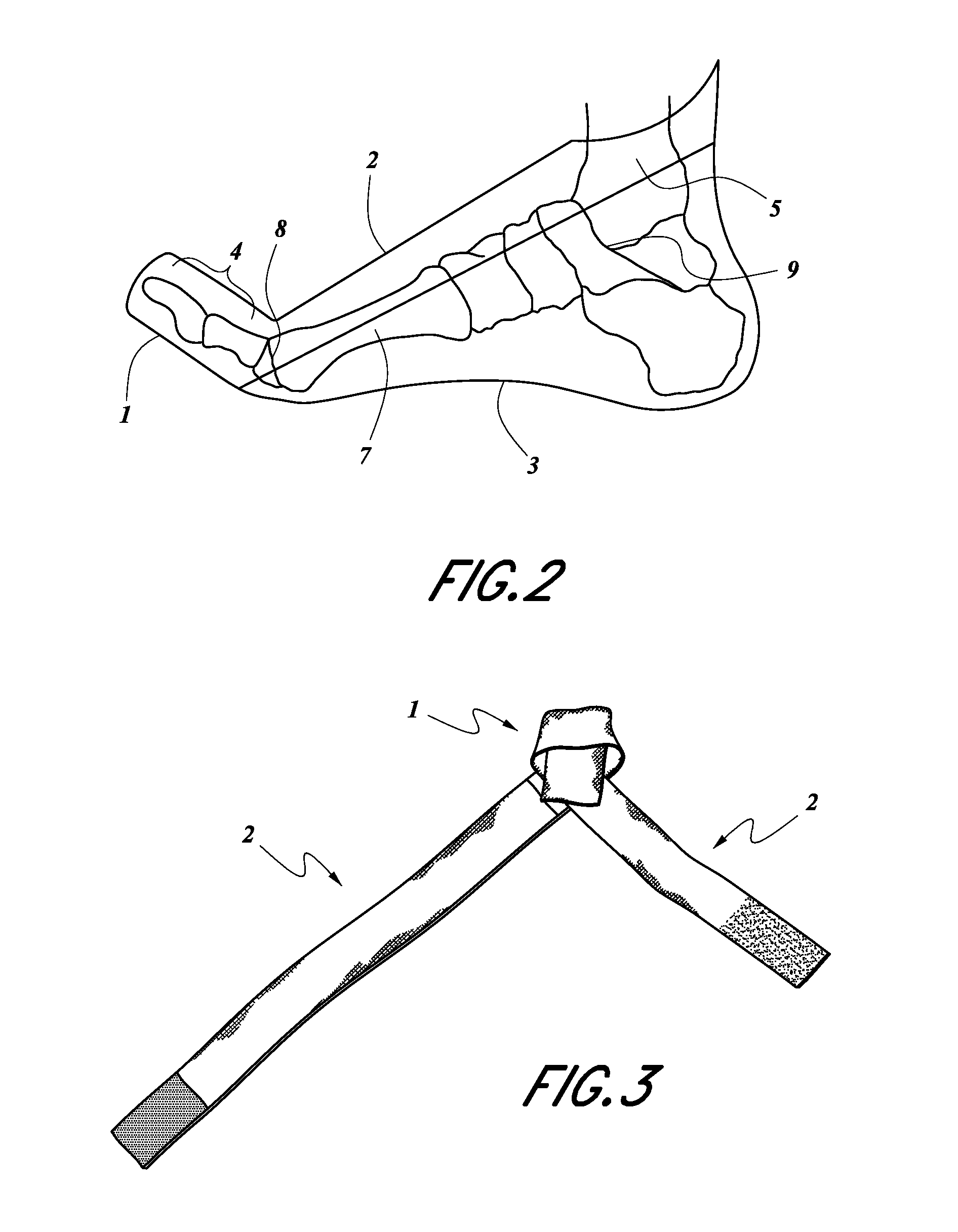 Dynamic hallux tension device for treatment of plantar faciitis