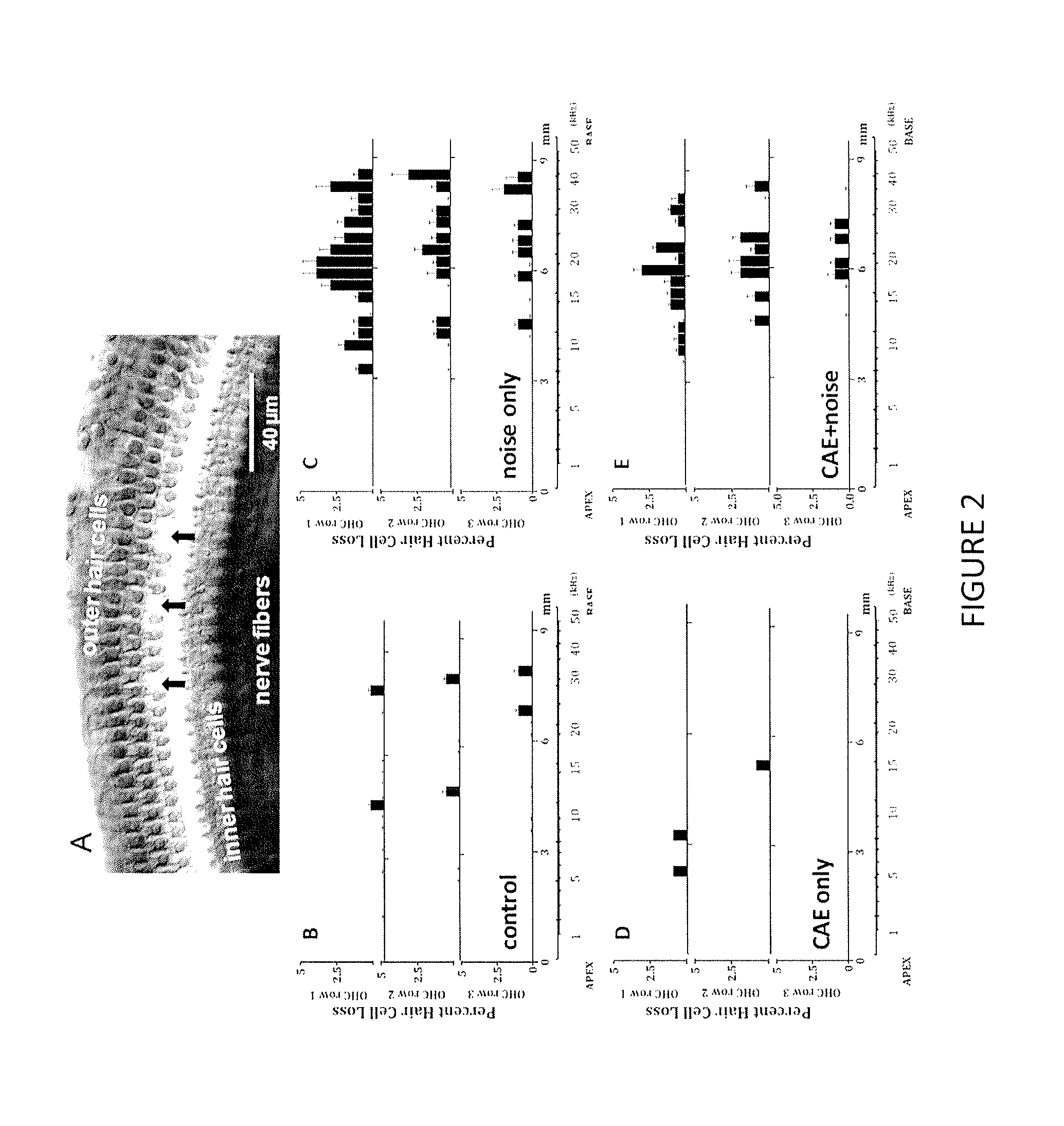 Methods and compositions for preventing and treating auditory dysfunctions