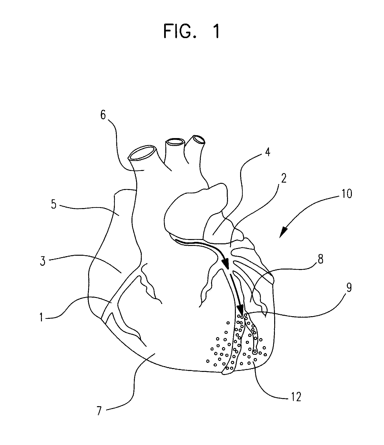 Methods, devices and compositions for controlled drug delivery to injured myocardium
