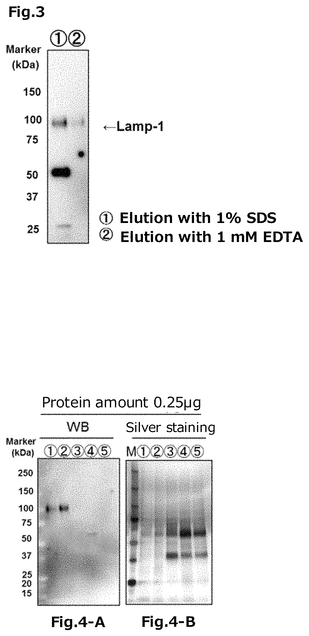Tim protein-bound carrier, methods for obtaining, removing and detecting extracellular membrane vesicles and viruses using said carrier, and kit including said carrier