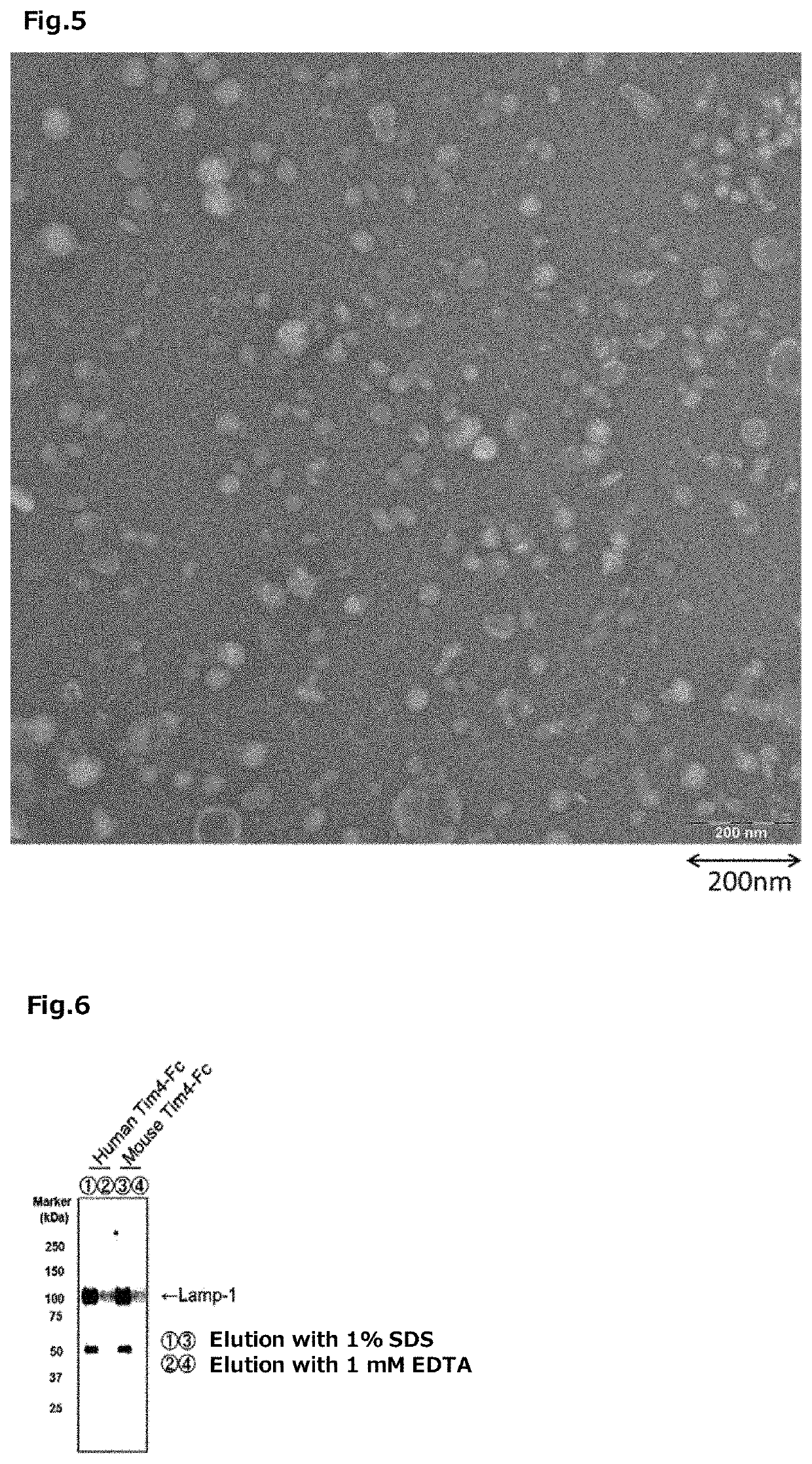 Tim protein-bound carrier, methods for obtaining, removing and detecting extracellular membrane vesicles and viruses using said carrier, and kit including said carrier