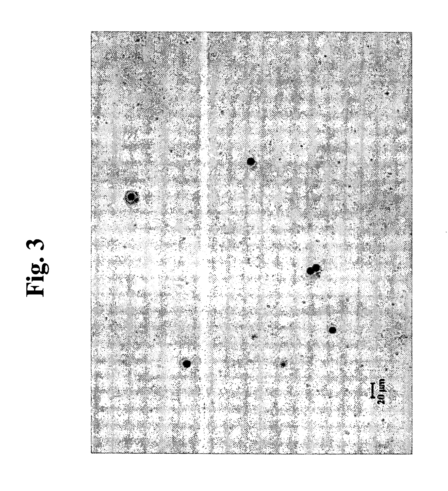 Method and system for sorting and separating particles