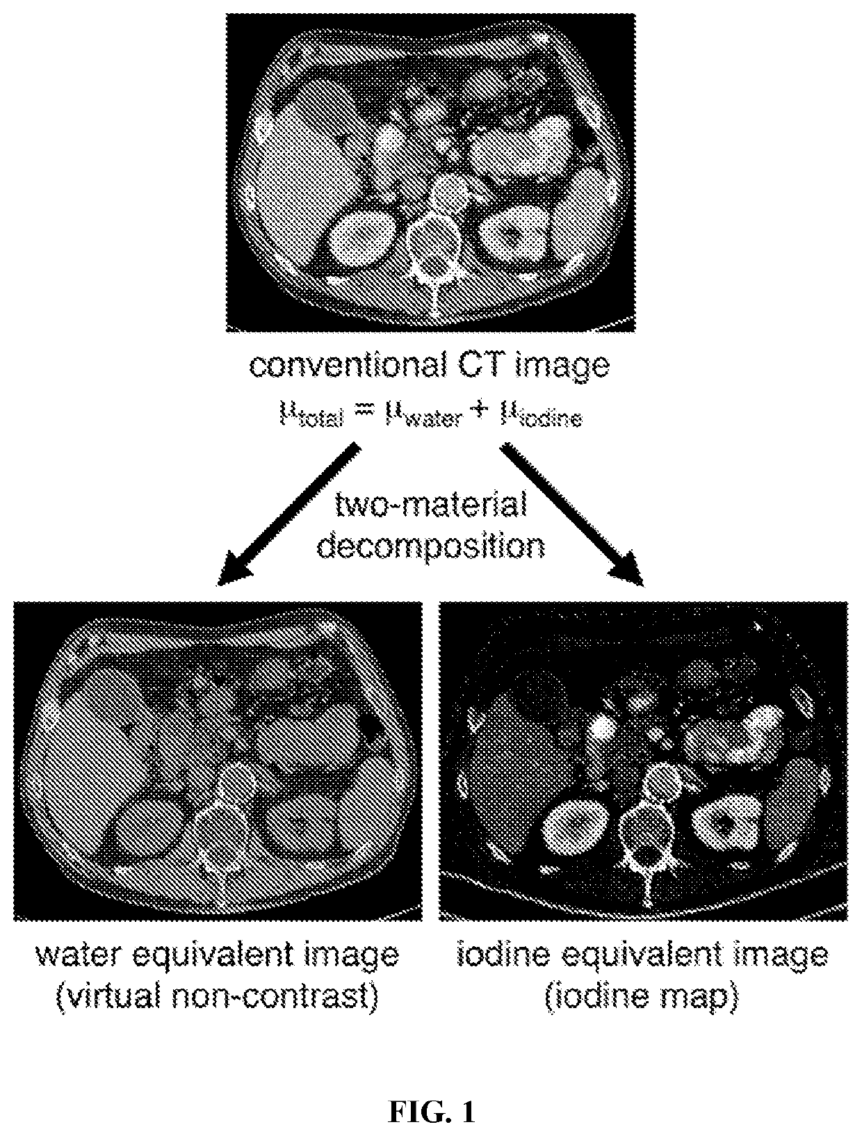 Contrast Agents and Methods of Making the Same for Spectral CT That Exhibit Cloaking and Auto-Segmentation