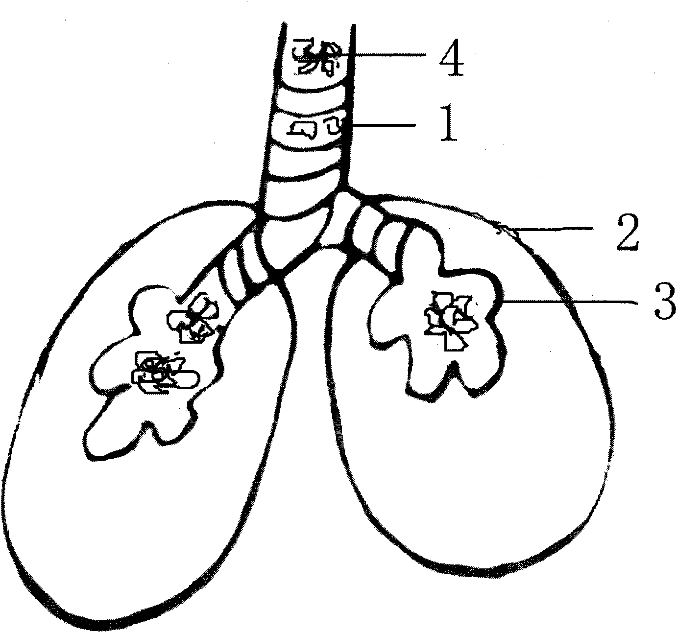Artificial sputum suction model