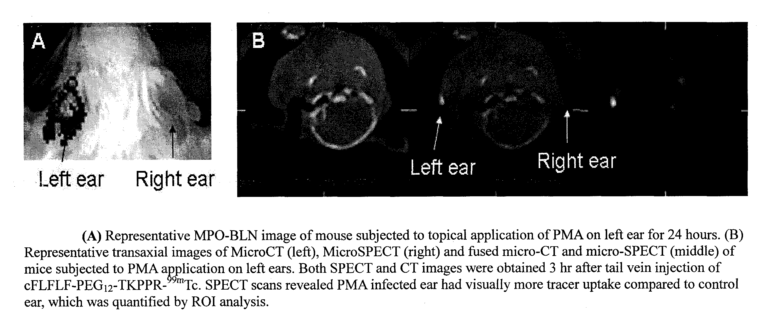 Compositions and methods for leukocyte-targeting multi-valent imaging probes