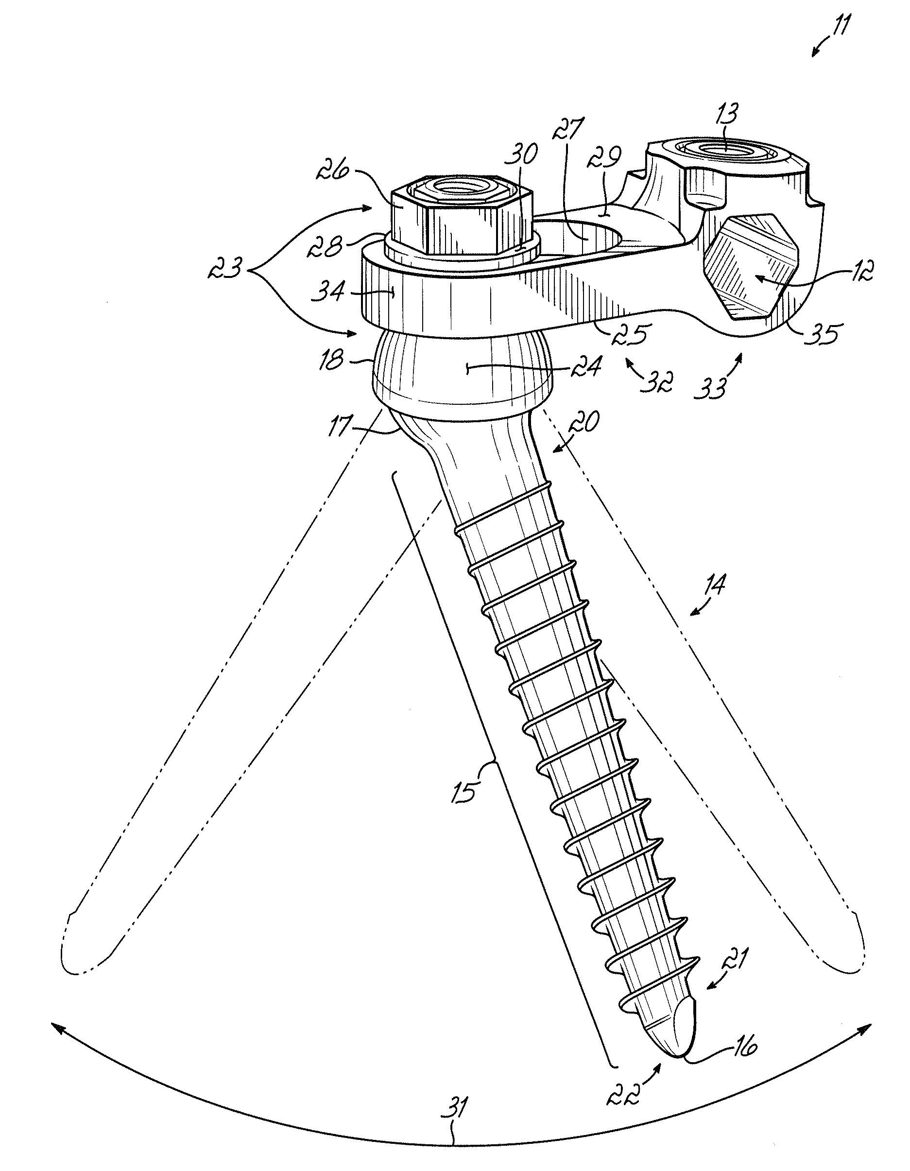 Spinal rod connector