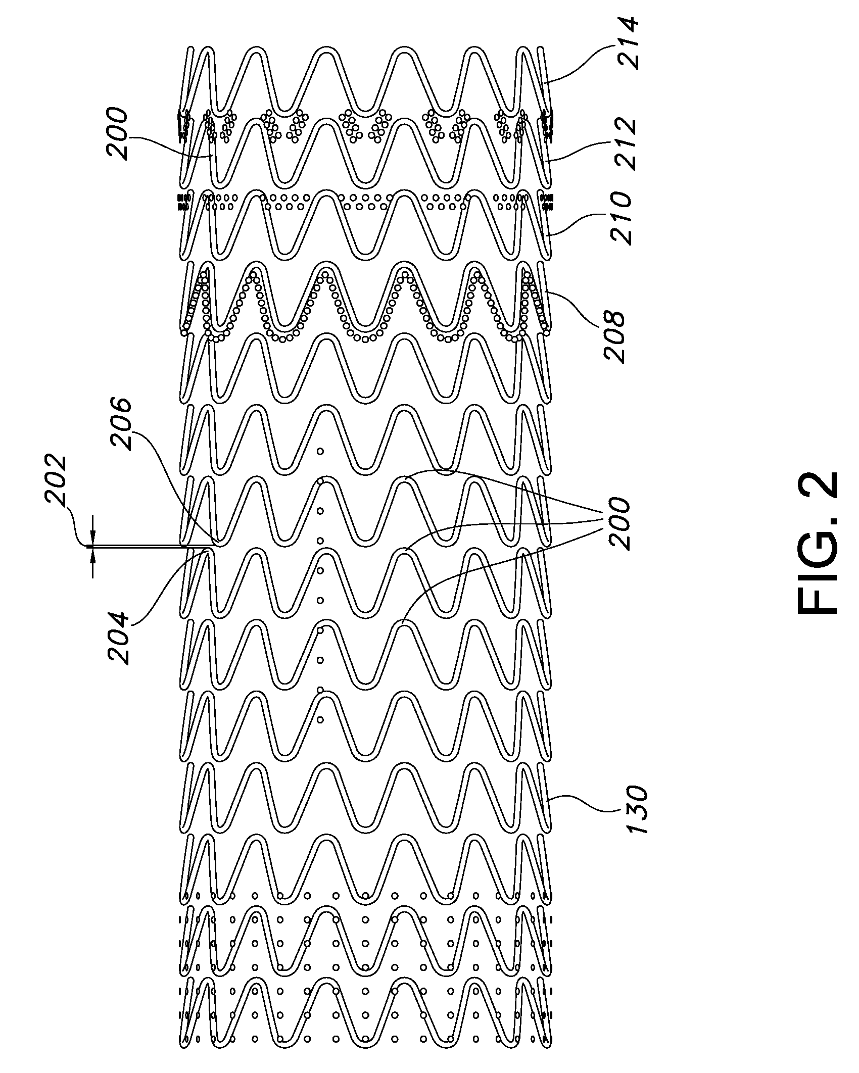Flexible Stent-Graft Device Having Patterned Polymeric Coverings