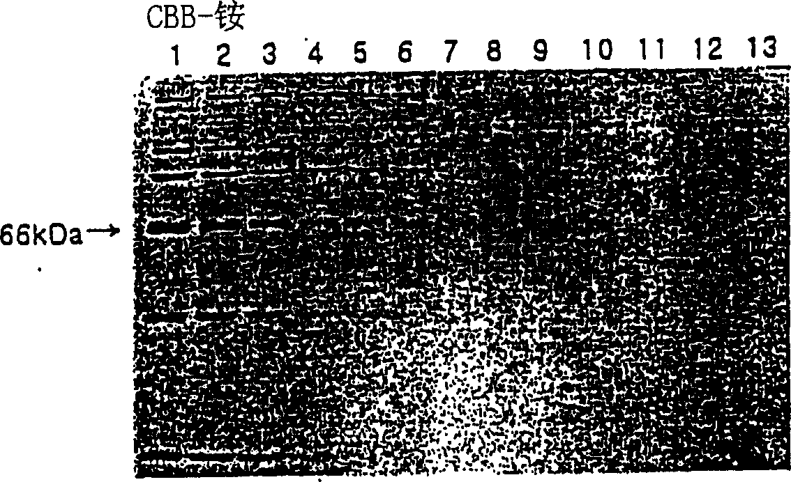 Treating solution containing aluminium ion for staining protein and staining method using the same