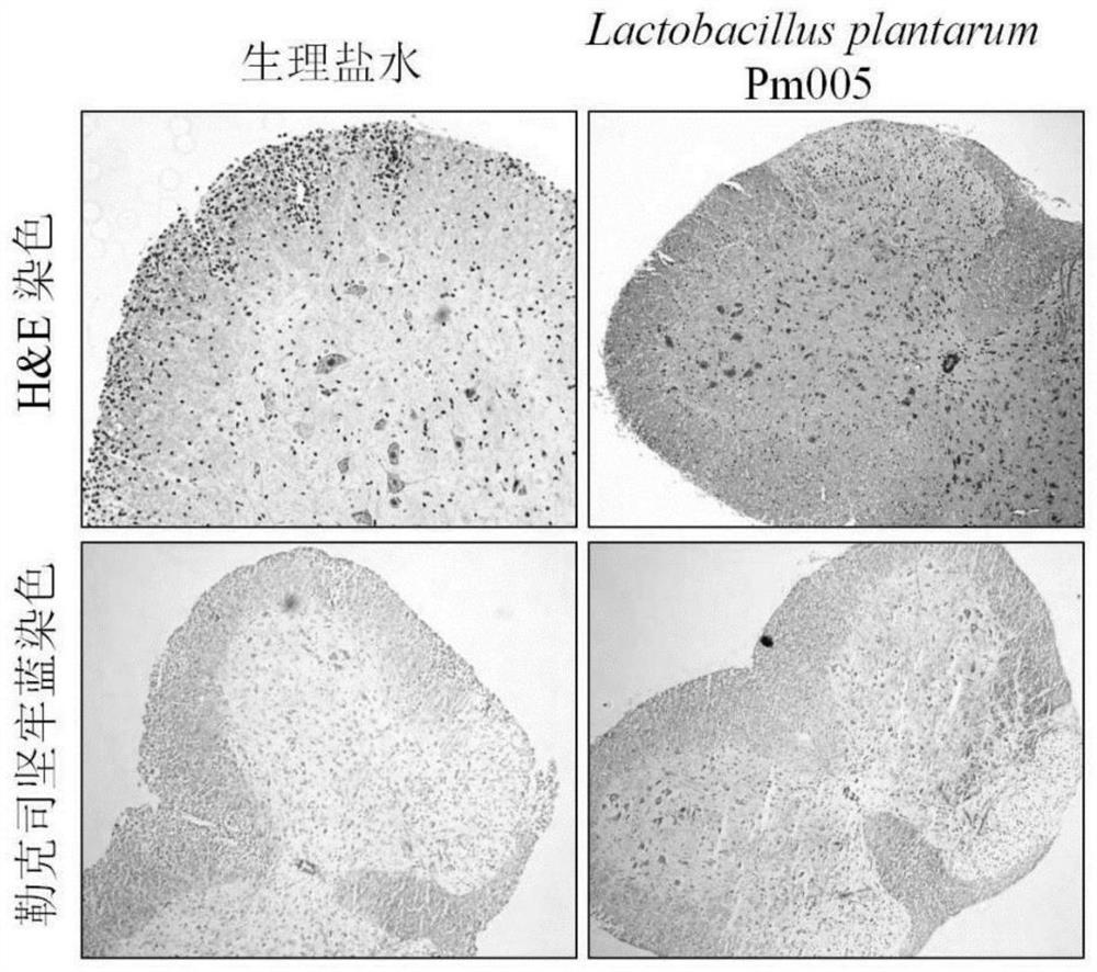 Lactobacillus plantarum and application thereof in prevention and/or treatment of central nervous system diseases