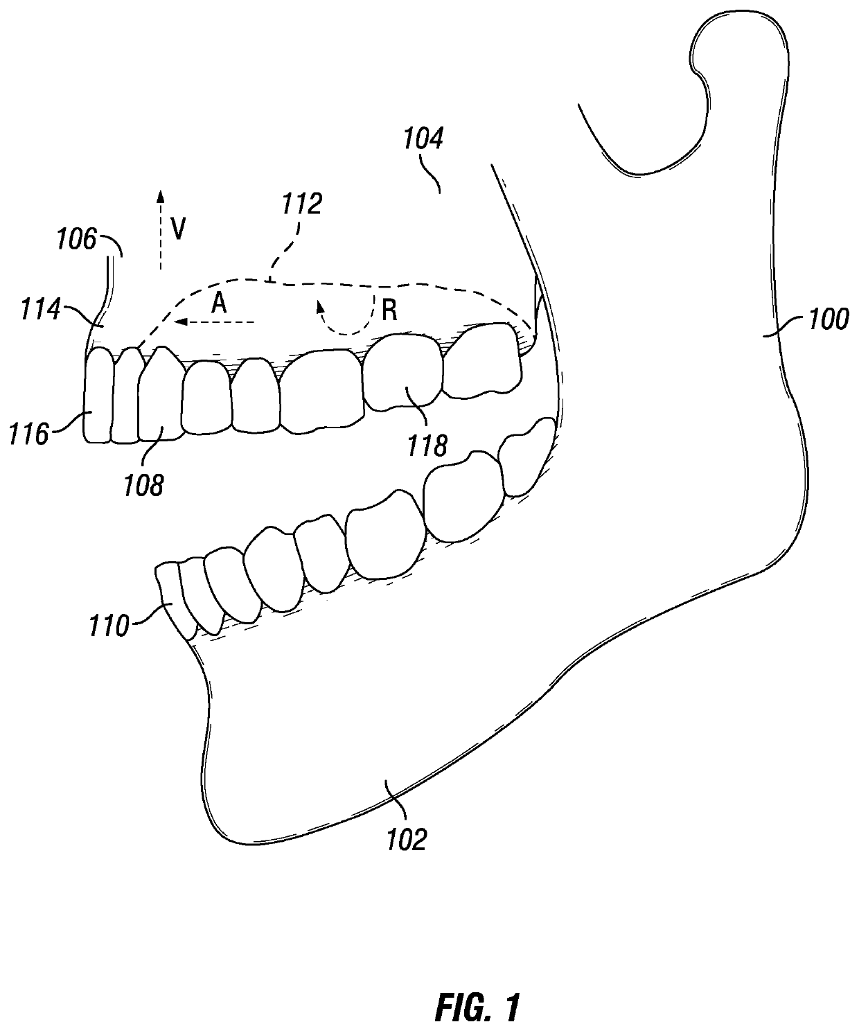 Dental system for symmetry of jaw, palate, and teeth