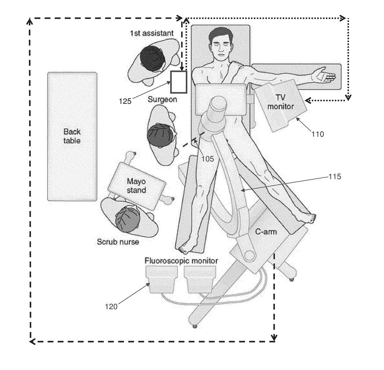 Method and apparatus for treating a joint, including the treatment of cam-type femoroacetabular impingement in a hip joint and pincer-type femoroacetabular impingement in a hip joint