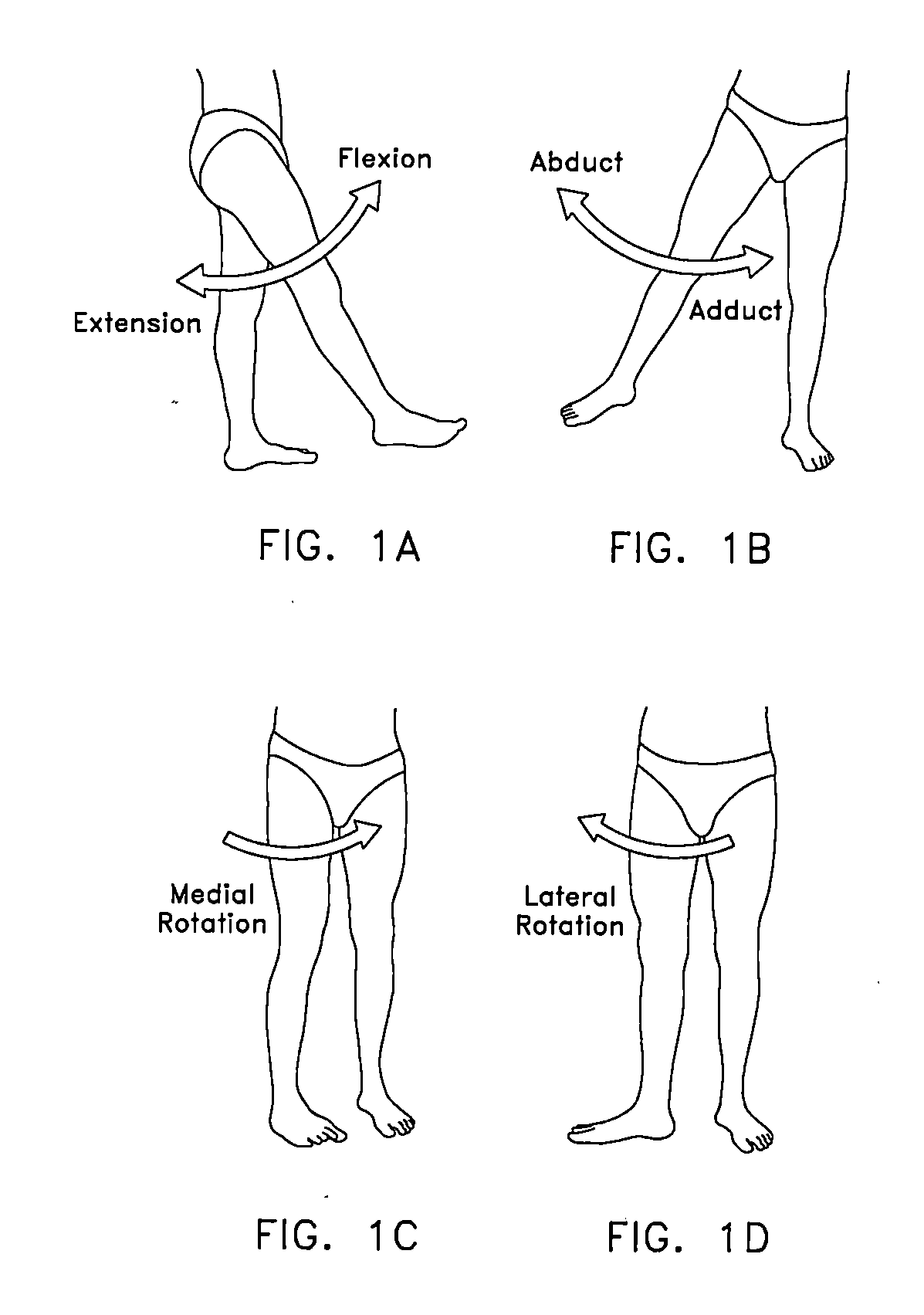 Method and apparatus for treating a joint, including the treatment of cam-type femoroacetabular impingement in a hip joint and pincer-type femoroacetabular impingement in a hip joint