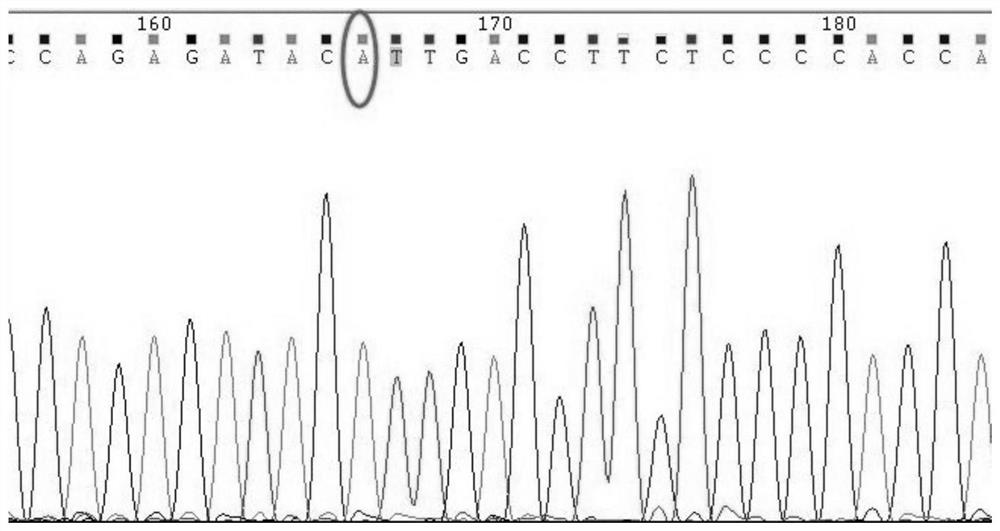 Gene detection kit for individualized administration of anti-epileptic drugs and application of gene detection kit