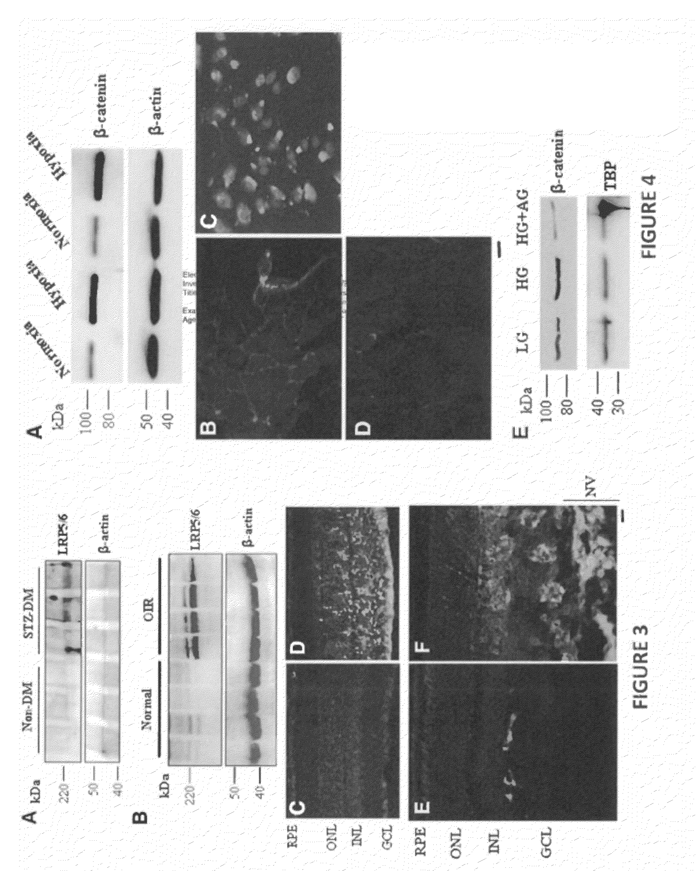 MONOCLONAL ANTIBODIES THAT INHIBIT THE Wnt SIGNALING PATHWAY AND METHODS OF PRODUCTION AND USE THEREOF