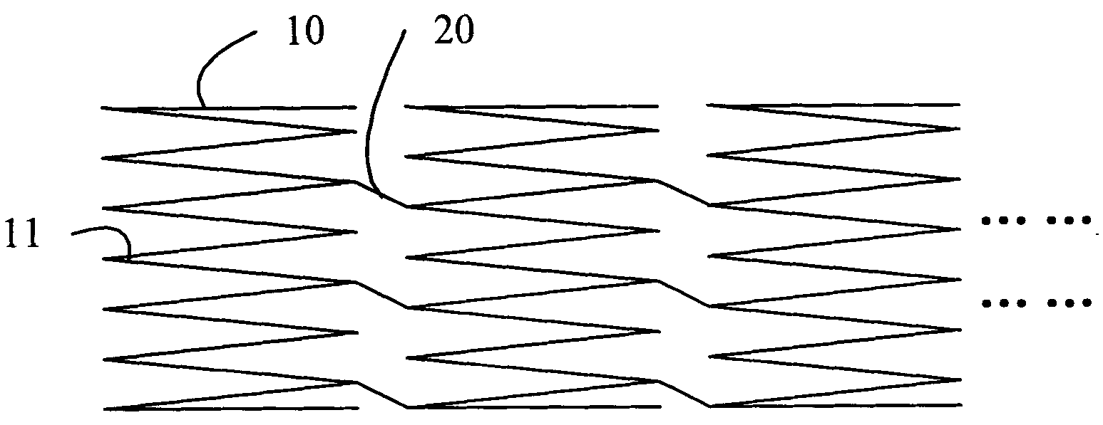 Pulmonary artery stent capable of subsequent dilation and conveyor thereof