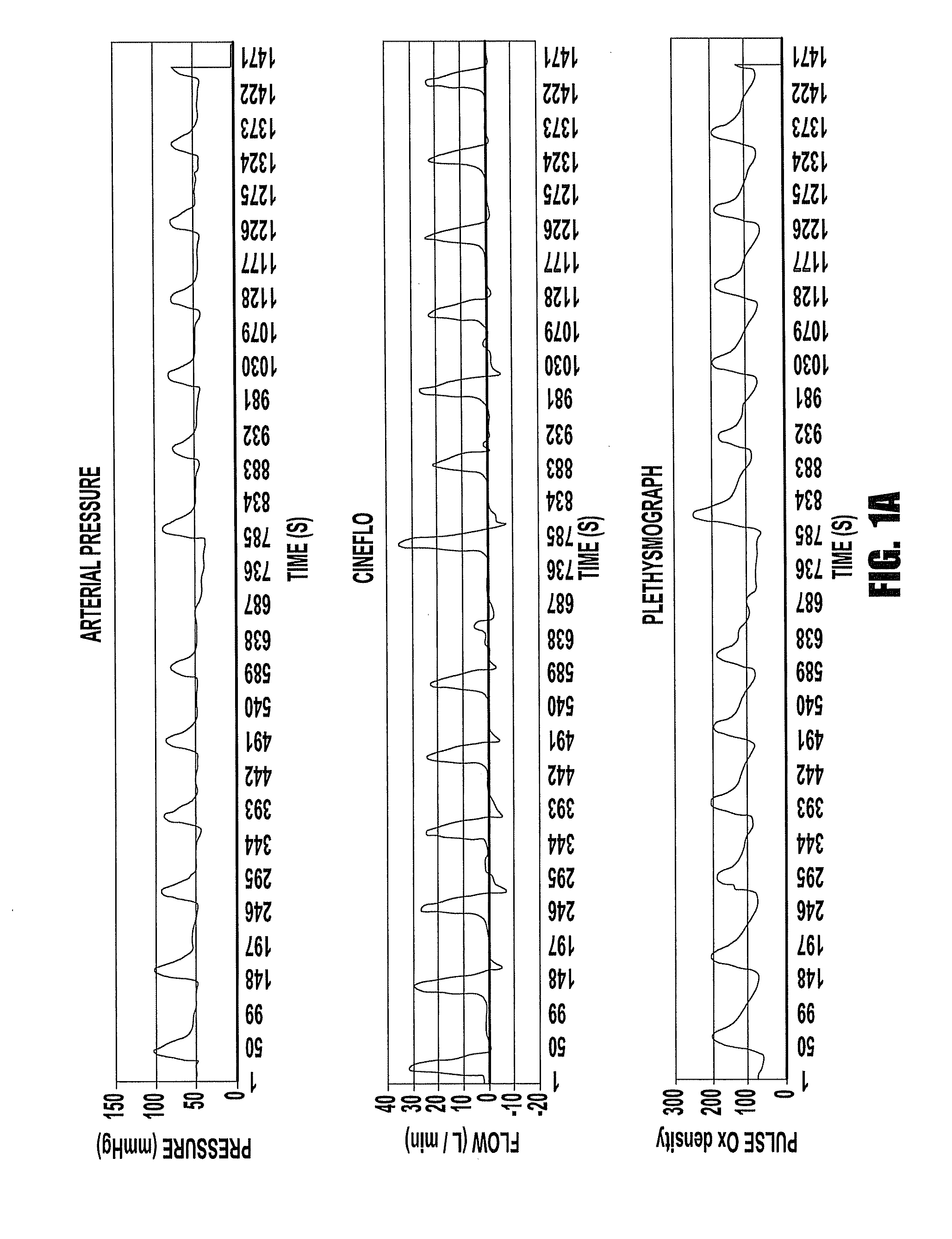 Device and system that identifies cardiovascular insufficiency