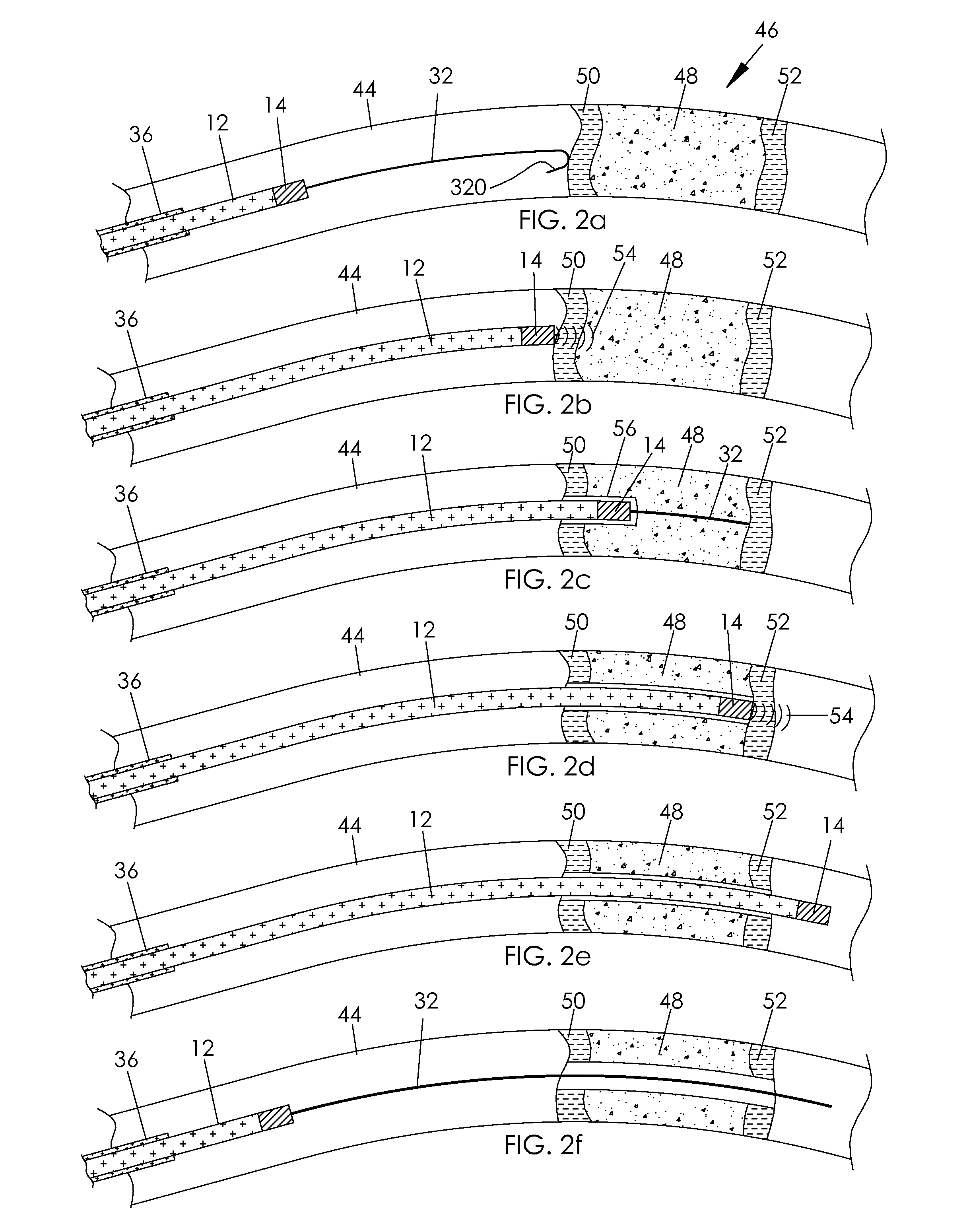 Method and system for assisting a wire guide to cross occluded ducts