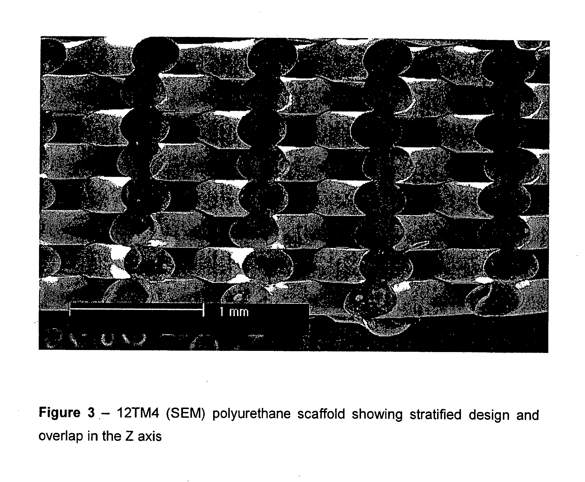 Biodegradable polyurethane and polyurethane ureas