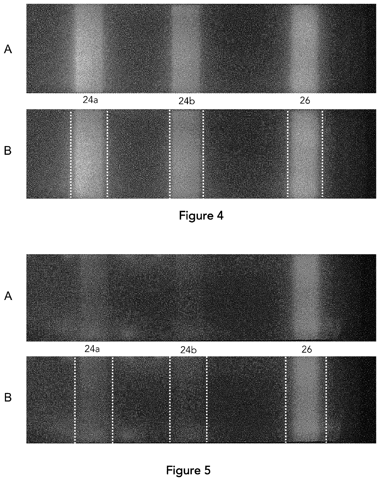 Assay membrane test region localization