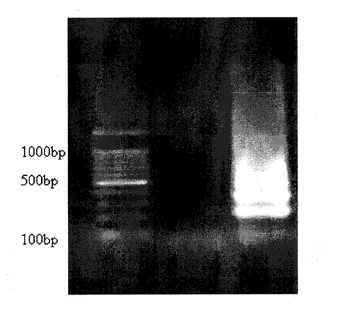 Reagent kit and method for detecting bacillus cereus with loop mediated isothermality amplification method