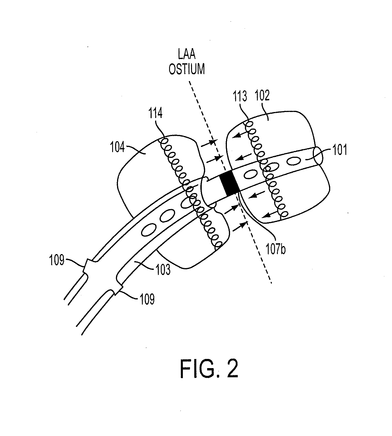 Methods and systems for accessing a pericardial space and preventing strokes arising from the left atrial appendage