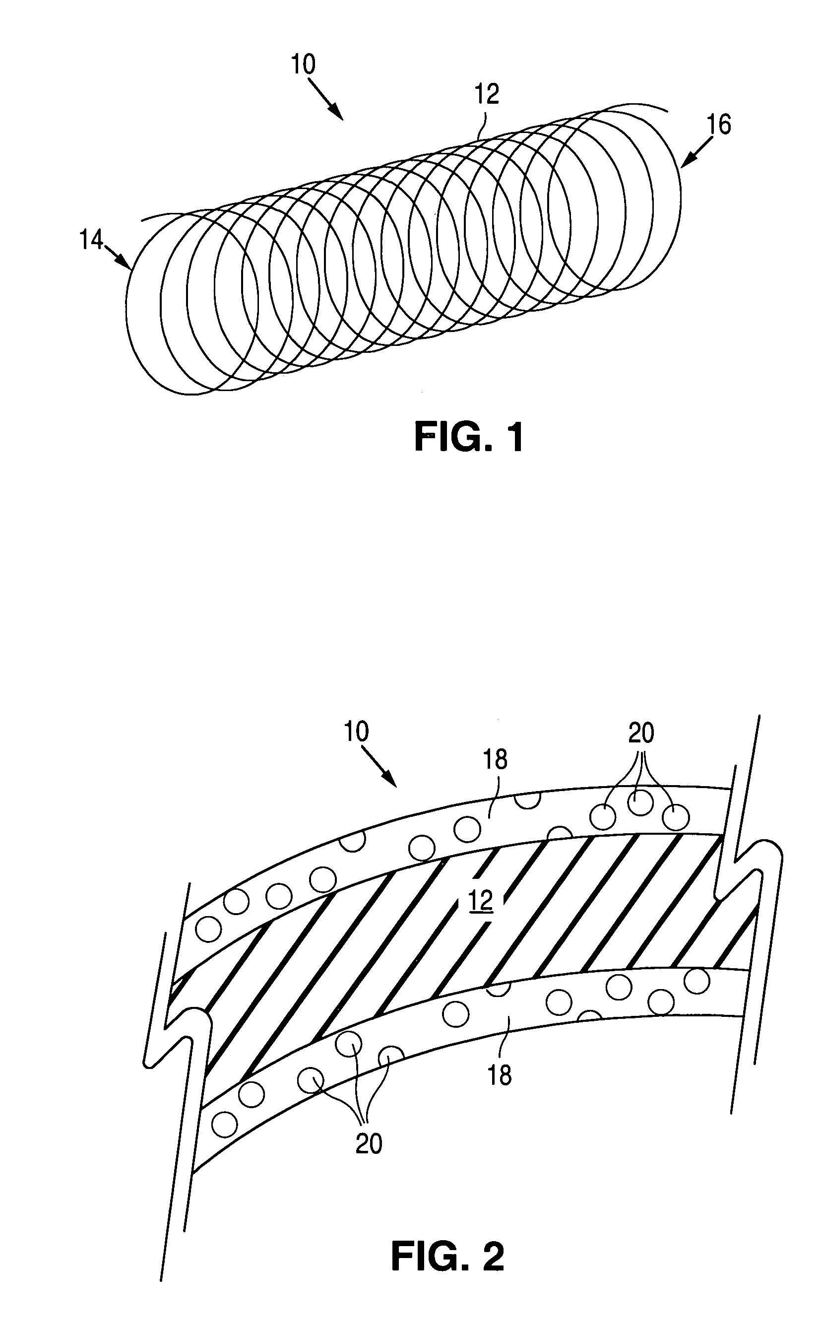 Methods of forming microparticle coated medical device