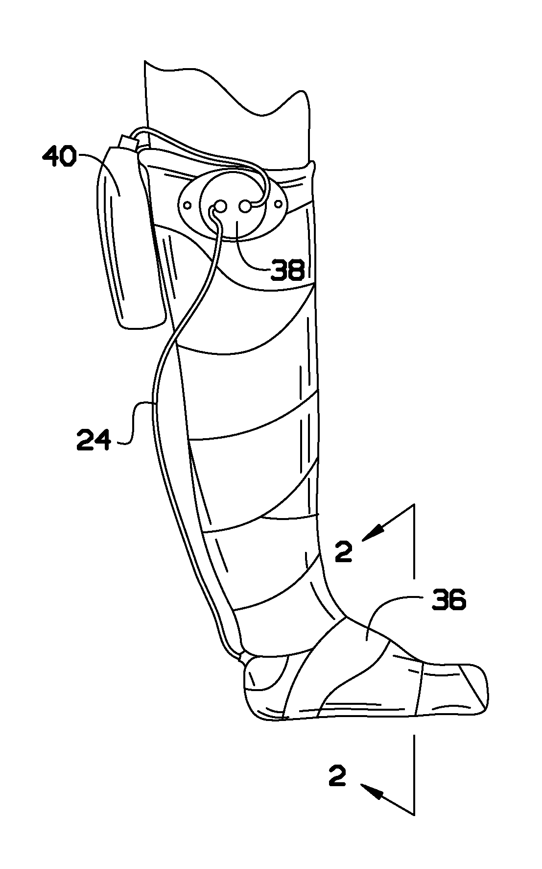 Vacuum cast ("vac-cast") and methods for treatment of plantar wounds