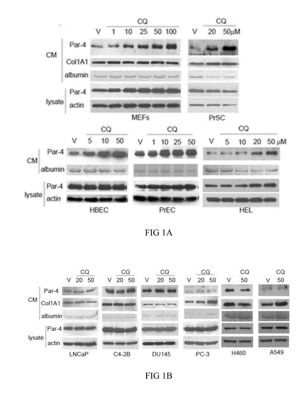 Chloroquine Induction of Par-4 and Treatment of Cancer