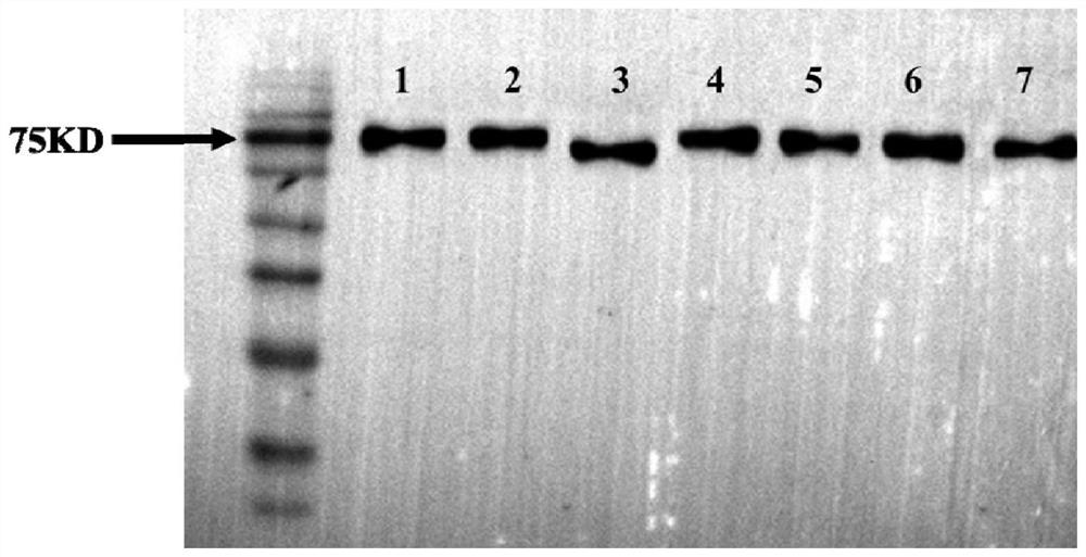 ELISA kit for detecting anti-NXP2 antibody and detection method and application thereof