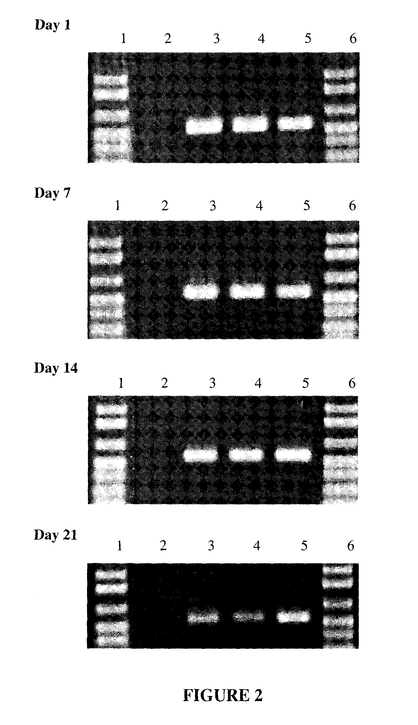 Compositions and method for storage of nucleic acid from bodily fluids