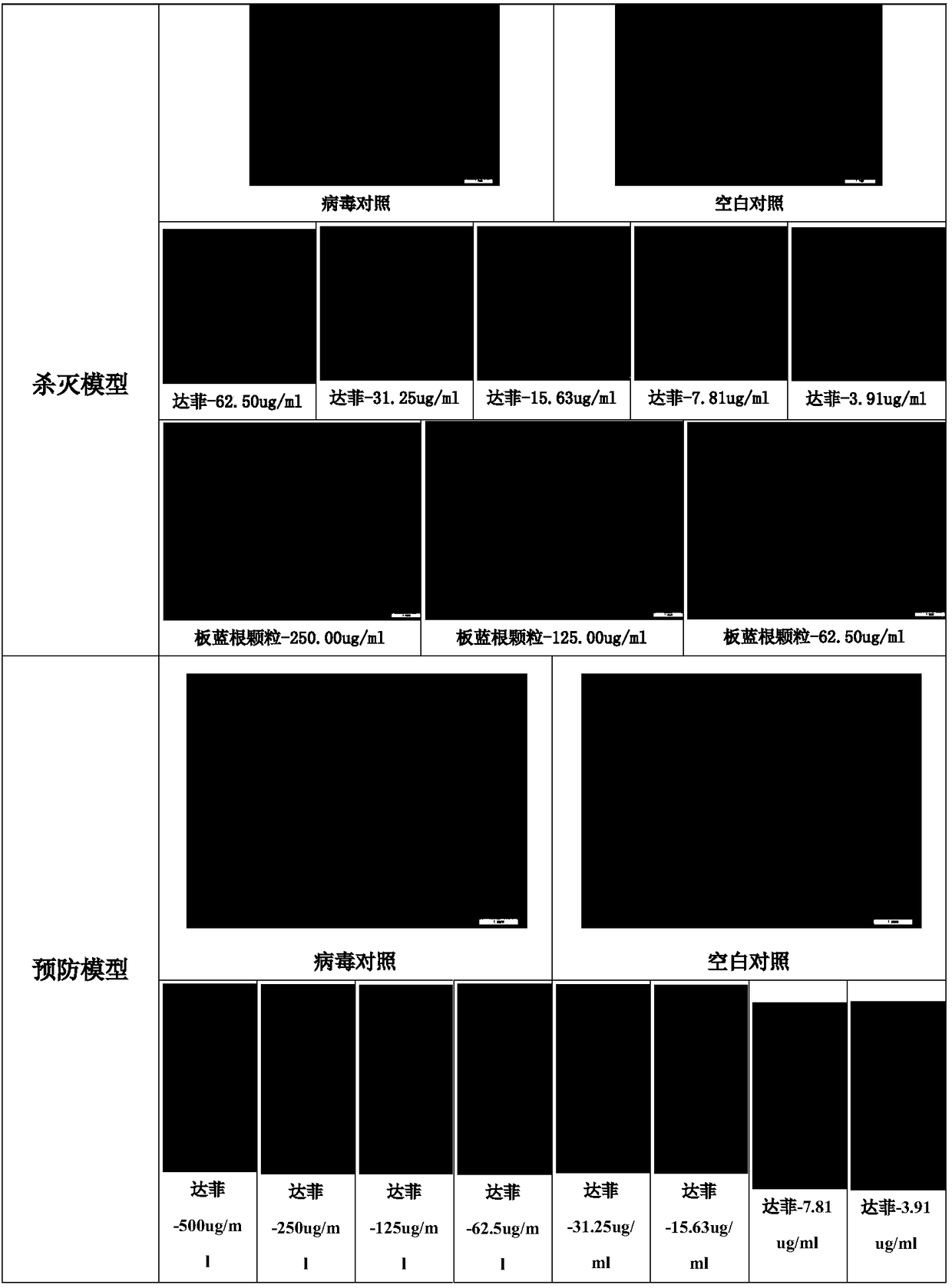 Anti-influenza virus use of wintersweet plants