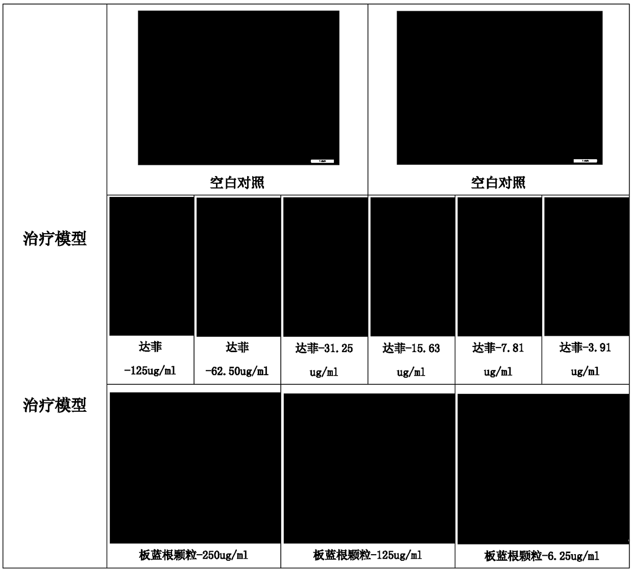 Anti-influenza virus use of wintersweet plants