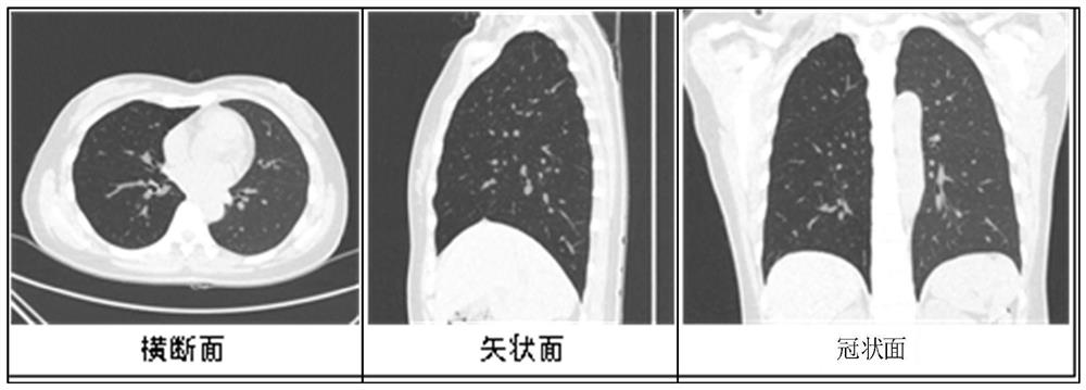 Automatic lung organ model leaf division method and system based on CT image